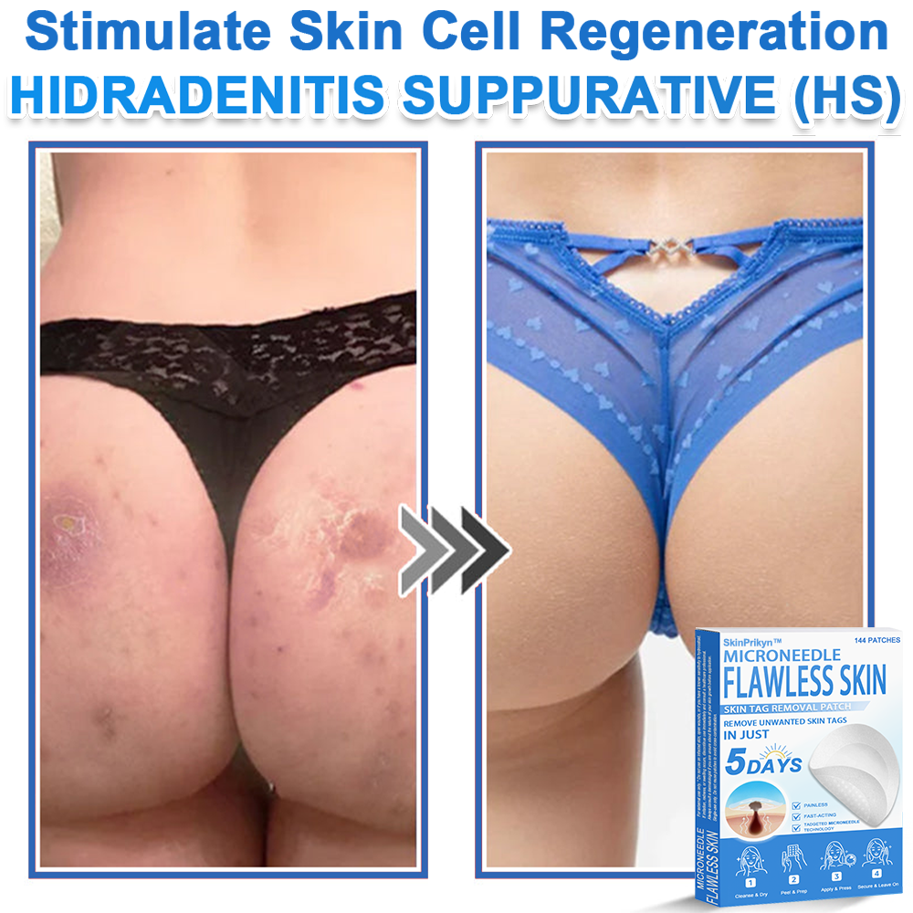 🎁 SkinPrikyn™ 2-in-1 Microneedle & Hydrocolloid Patch