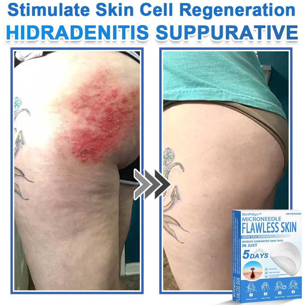 🎁 SkinPrikyn™ 2-in-1 Microneedle & Hydrocolloid Patch