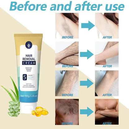 Furzero™ Gentle Depilatory Cream