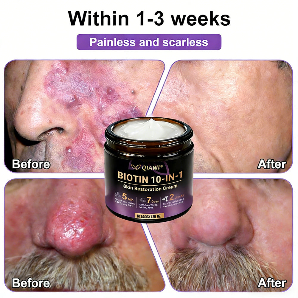Made and Shipped from USA ✨QIAWI® Proprietary Biotin Blend Skin Restoration Cream 🍀